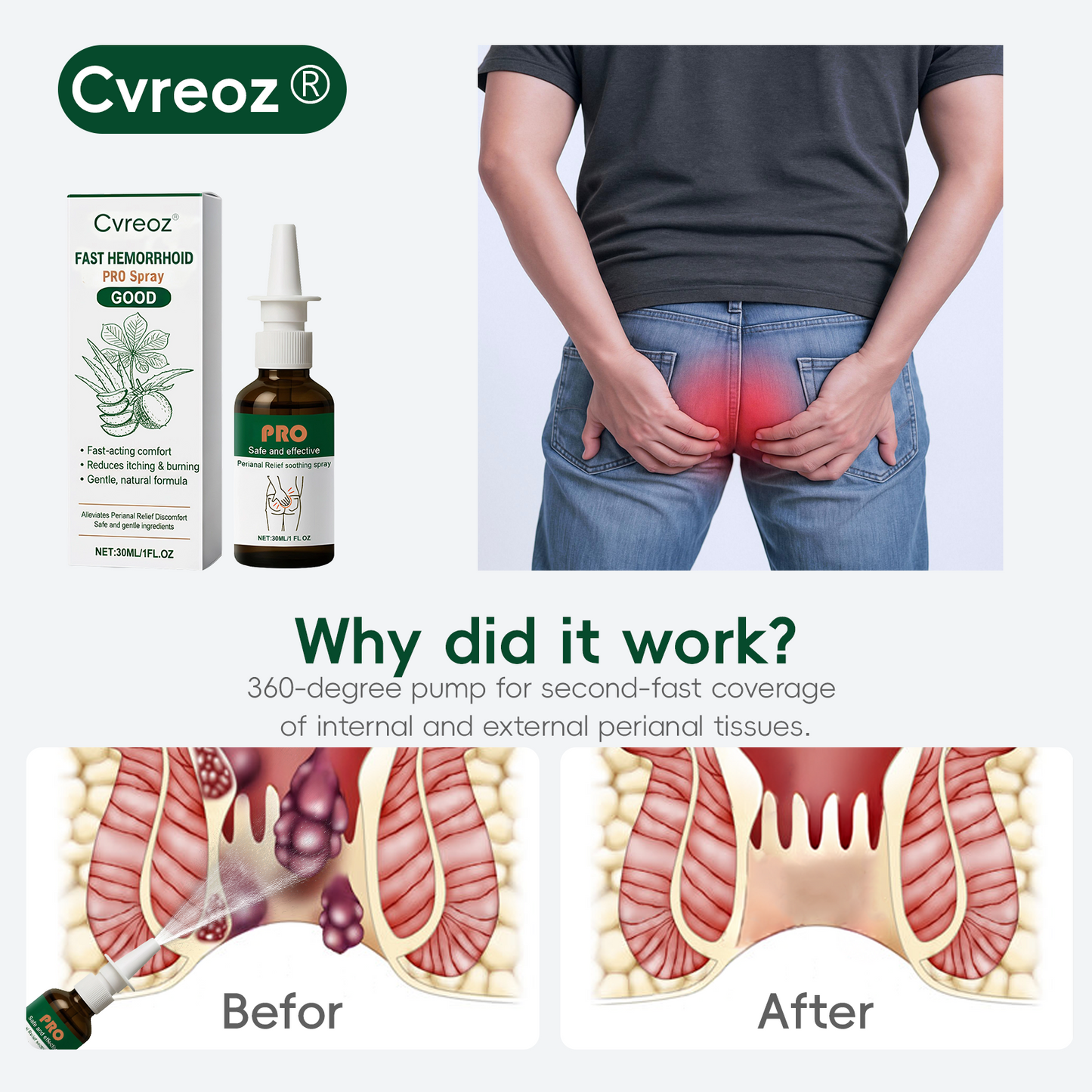 Cvreoz® Fast Hemorrhoid PRO Spray🍑