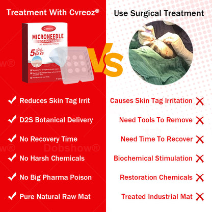 Cvreoz®MicroNeedle BotanicSkin Tag Removal Patch