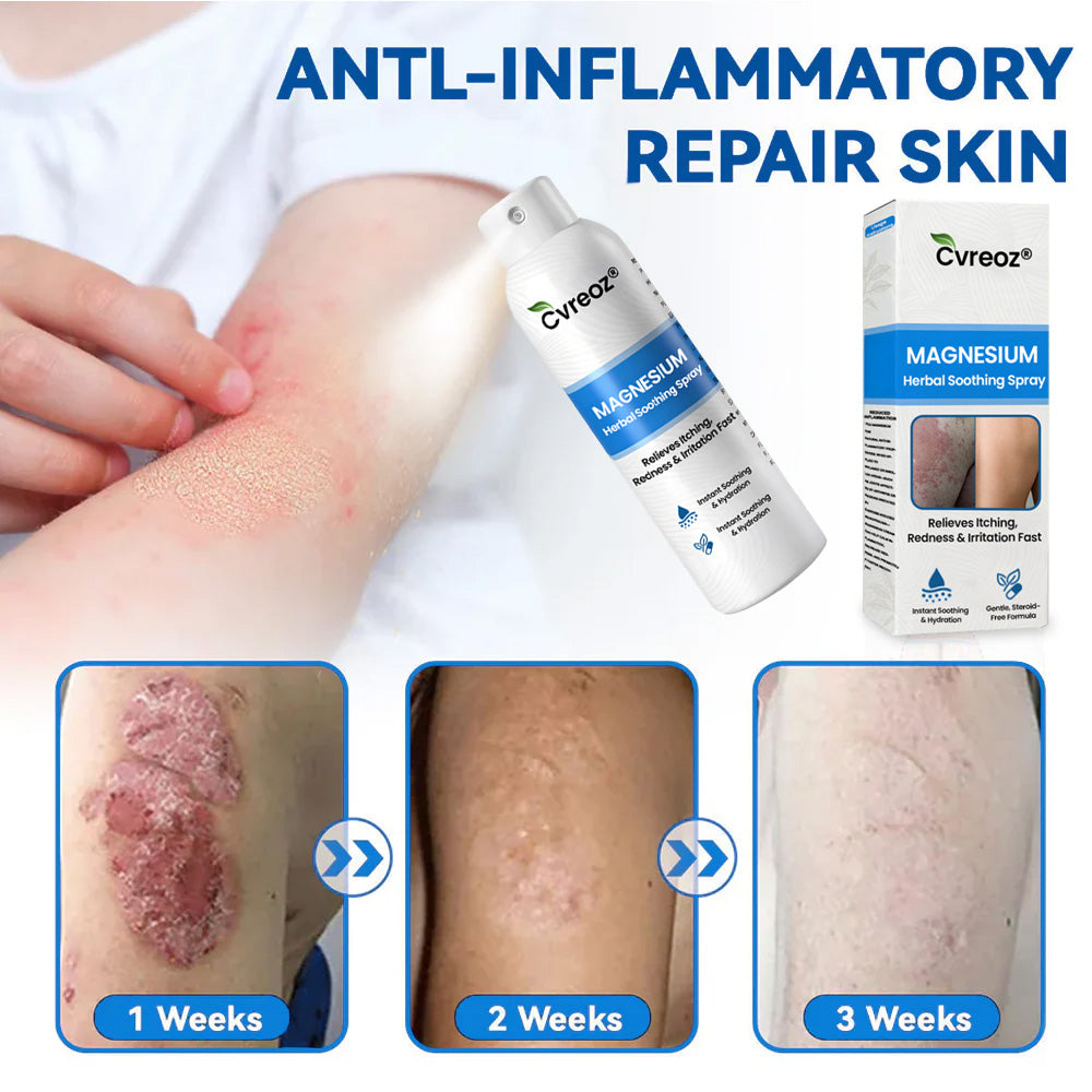 🔥Final 3 Hours: 80% OFF:Cvreoz® Magnesium Herbal Psoriasis Spray⚕️ FDA Certified (for the treatment of psoriasis and eczema, improvement of bacterial infections in the genital area, treatment of acne and warts, eliminates psoriasis and eczema, etc.)