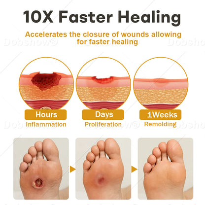 🔥 𝘽𝙚𝙨𝙩 𝙎𝙚𝙡𝙡𝙚𝙧 | Healrize® GlucoShield Bee Venom Wound Spray🐝