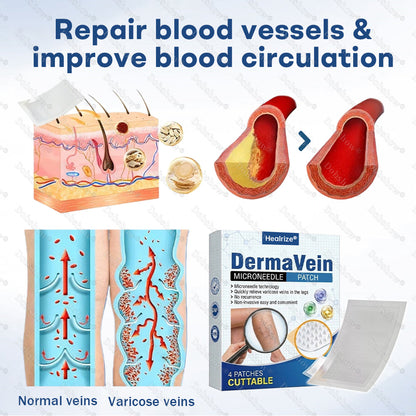Healrize® DermaVein Microneedle Patch