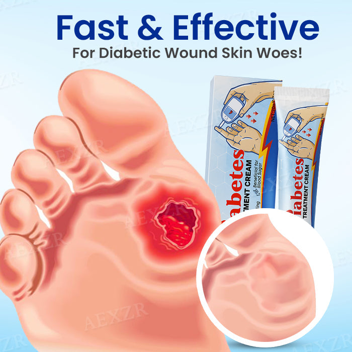 Cvreoz® Diabetes Treatment Cream