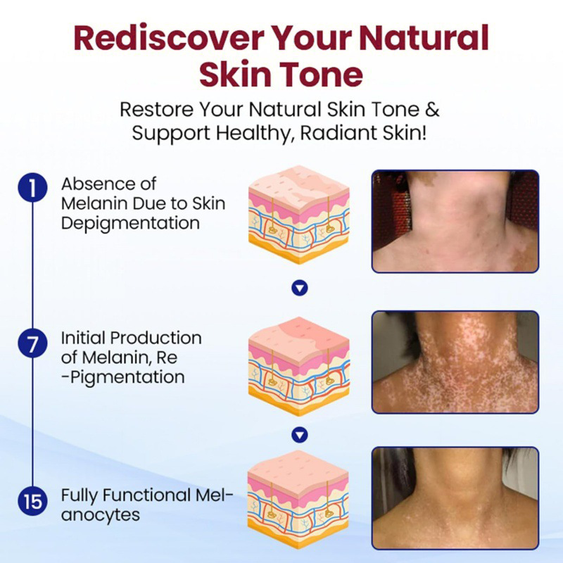 Healrize® Rapid Repair Vitiligo Essence