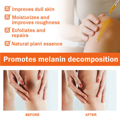 Dobshow® Acanthosis Nigricans Treatment Oil