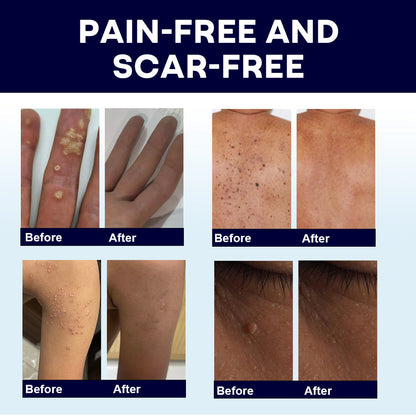 🔥Cyber Monday Sale🔥 | AAFQ® WartLock CRYO RECOVERY SPRAY