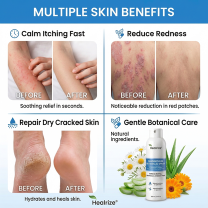 🇺🇸 Official Store| Healrize® Magnesium Botanical Spray – 🥇 Fast Relief for Psoriasis & Eczema | No Rubbing, Steroid-Free