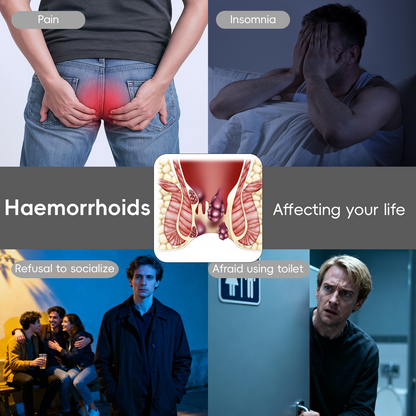Cvreoz® Fast Hemorrhoid PRO Spray🍑