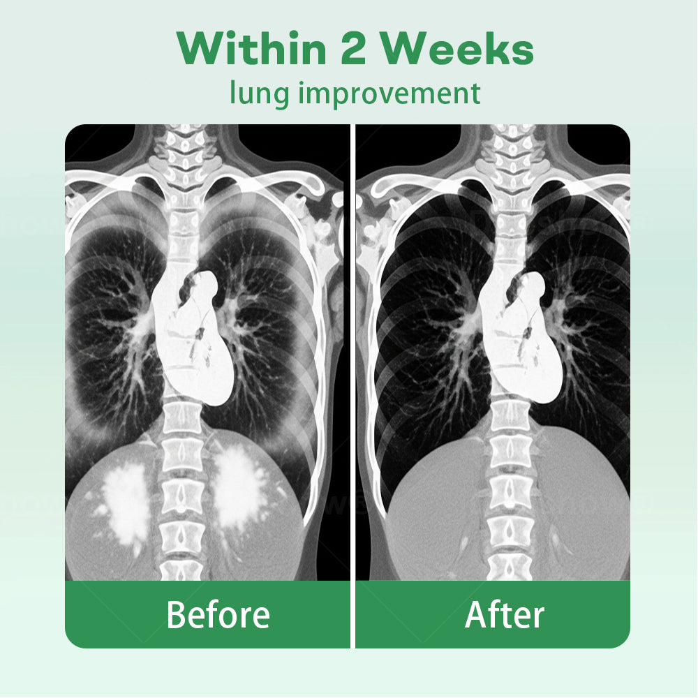 ✅Official Store| 𝐂𝐯𝐫𝐞𝐨𝐳® 𝐇𝐞𝐫𝐛𝐚𝐥 𝐋𝐮𝐧𝐠 𝐂𝐥𝐞𝐚𝐧𝐬𝐢𝐧𝐠 𝐈𝐧𝐡𝐚𝐢𝐞𝐫(🫁Cough, wheezing, shortness of breath, sputum, stuffy nose, bronchitis, bronchitis, allergy symptoms, lung discomfort💝)