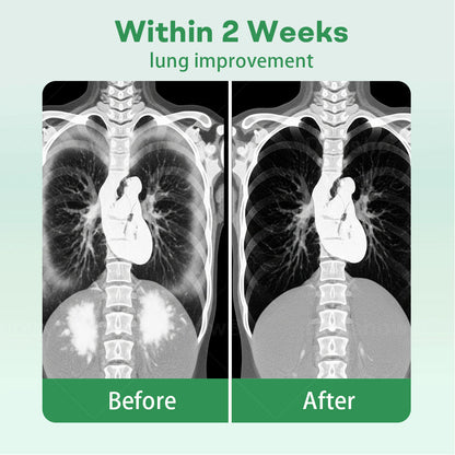 ✅Official Store| 𝐂𝐯𝐫𝐞𝐨𝐳® 𝐇𝐞𝐫𝐛𝐚𝐥 𝐋𝐮𝐧𝐠 𝐂𝐥𝐞𝐚𝐧𝐬𝐢𝐧𝐠 𝐈𝐧𝐡𝐚𝐢𝐞𝐫(🫁Cough, wheezing, shortness of breath, sputum, stuffy nose, bronchitis, bronchitis, allergy symptoms, lung discomfort💝)