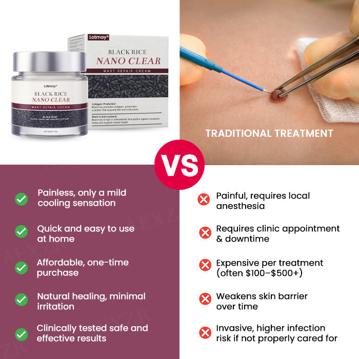 🔥𝙎𝙥𝙚𝙘𝙞𝙖𝙡 𝙋𝙧𝙤𝙢𝙤𝙩𝙞𝙤𝙣 | Lotmay® BlackRice Nano Clear Wart Repair Cream
