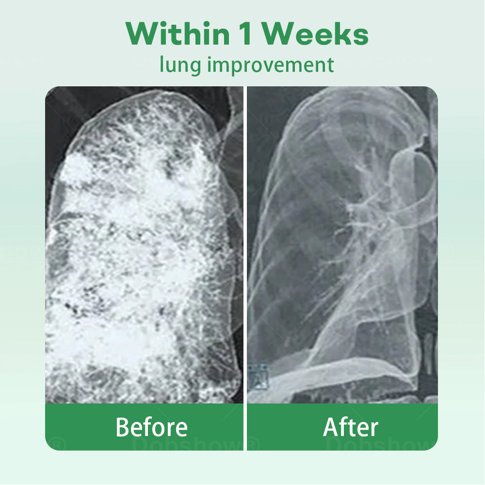 ✅Official Store| Healrize® 𝐇𝐞𝐫𝐛𝐚𝐥 𝐋𝐮𝐧𝐠 𝐂𝐥𝐞𝐚𝐧𝐬𝐢𝐧𝐠 𝐈𝐧𝐡𝐚𝐢𝐞𝐫(🫁Cough, wheezing, shortness of breath, sputum, stuffy nose, bronchitis, bronchitis, allergy symptoms, lung discomfort💝)