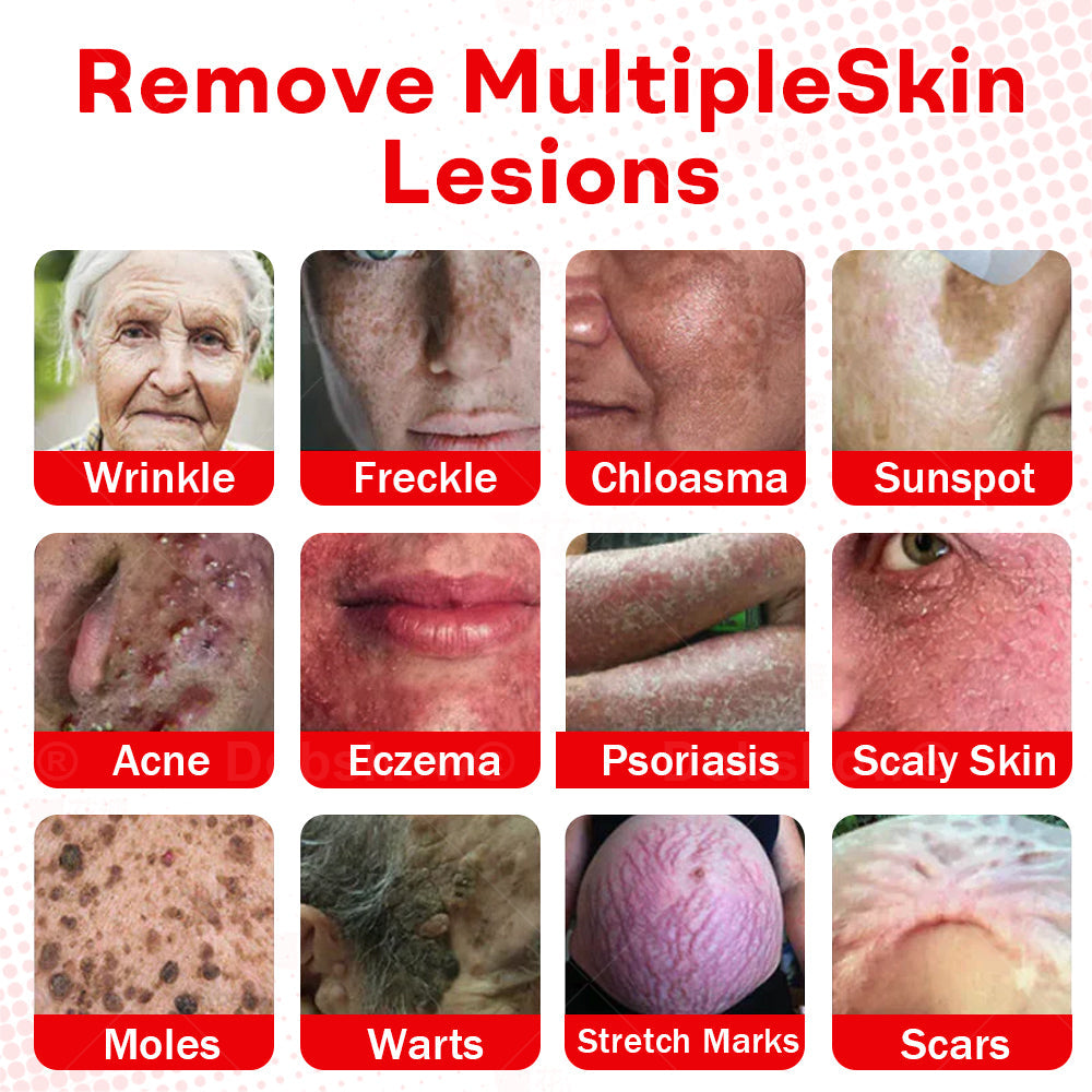 Cvreoz®MicroNeedle BotanicSkin Tag Removal Patch