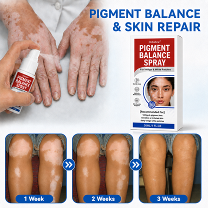 🔥 𝘽𝙚𝙨𝙩 𝙎𝙚𝙡𝙡𝙚𝙧 | Dobshow® Pigment Balance Spray– Targeted Vitiligo & White Patch Care | Supports Melanin Production, Pigment Balance & Natural-Looking Skin Tone