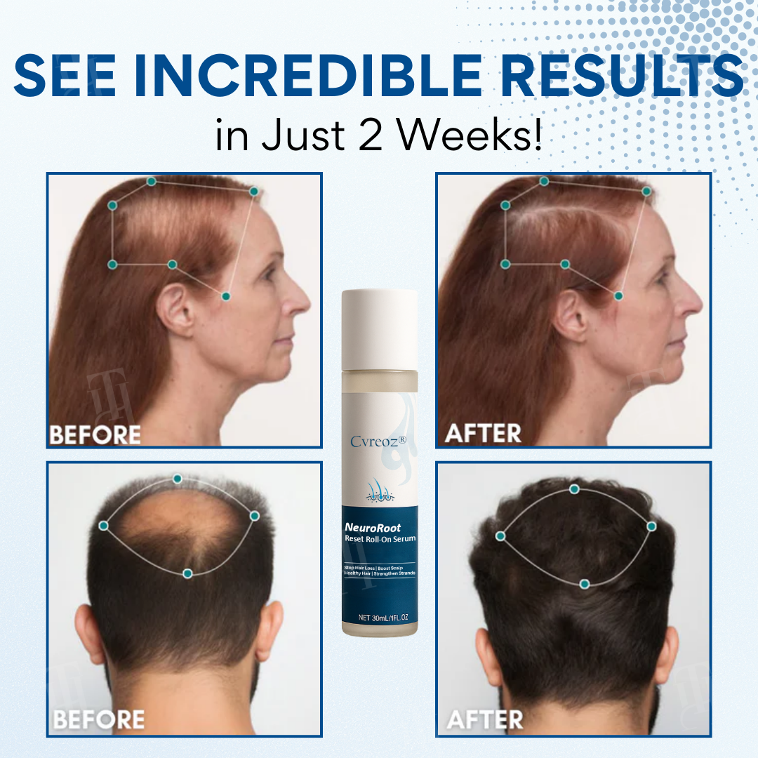 ✨𝙇𝙞𝙢𝙞𝙩𝙚𝙙-𝙏𝙞𝙢𝙚 𝙊𝙛𝙛𝙚𝙧   | Cvreoz® NeuroRoot Reset Roll-On Serum