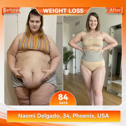 Nawaru® 𝐌𝐨𝐫𝐢𝐧𝐠𝐚 & 𝐁𝐞𝐫𝐛𝐞𝐫𝐢𝐧𝐞 4‑In‑1 Micro‑Particle Sculpting & Fat‑Burn Shorts