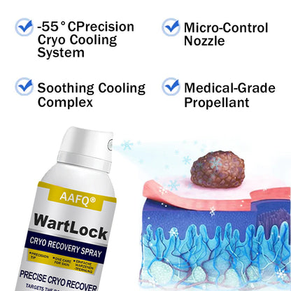 AAFQ® WartLock CRYO RECOVERY SPRAY