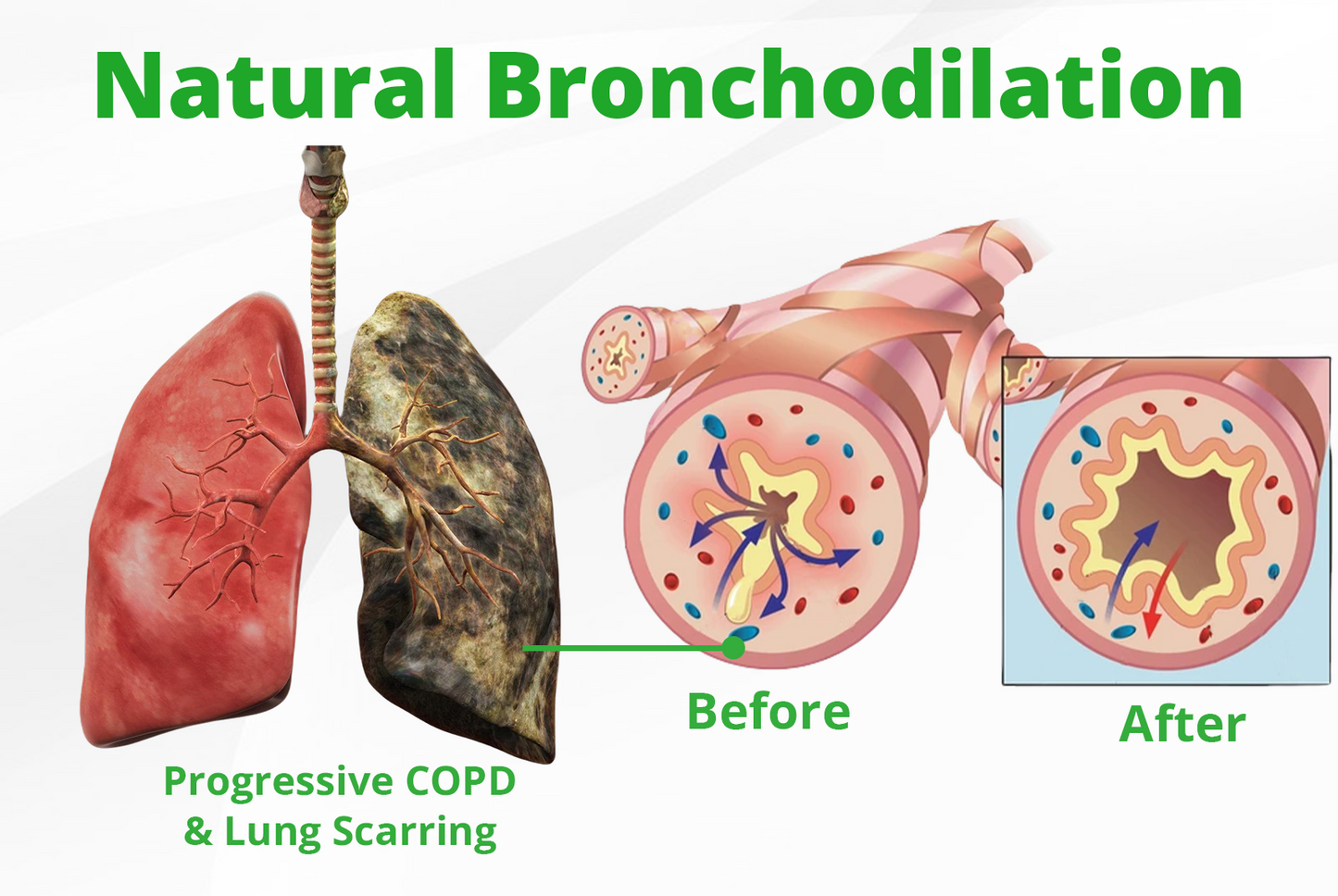 Croaie® Pulmovia Quercetin Inhaler — Deep Lung Detox  Natural Relief for Cough & Shortness of Breath