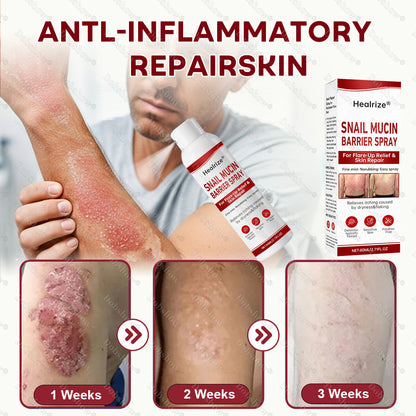 🚀Healrize® Snail Mucin Barrier Spray for Flare-Up Relief & Skin Repair
