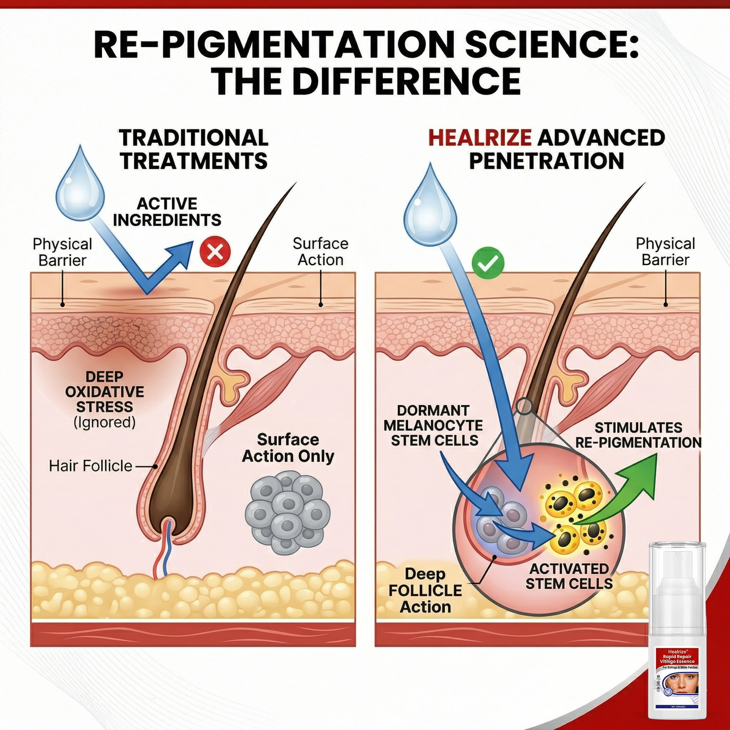Healrize® Rapid Repair Vitiligo Essence