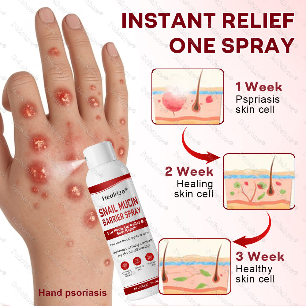 🚀Healrize® Snail Mucin Barrier Spray for Flare-Up Relief & Skin Repair