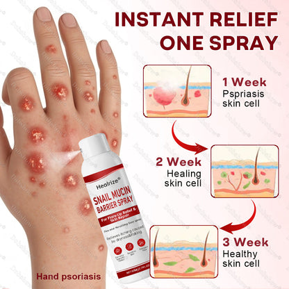 🚀Healrize® Snail Mucin Barrier Spray for Flare-Up Relief & Skin Repair