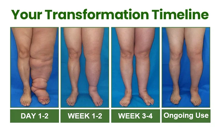 Healrize® Light Legs Swelling & Circulation Relief Spray