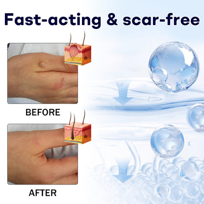 🔥Cyber Monday Sale🔥 | AAFQ® WartLock CRYO RECOVERY SPRAY