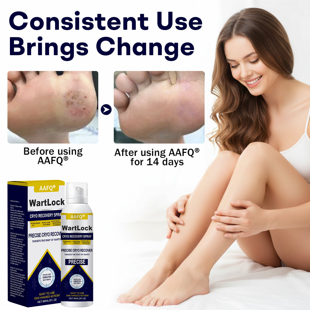 AAFQ® WartLock CRYO RECOVERY SPRAY