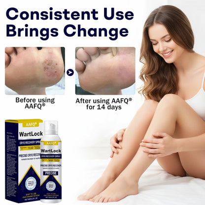 AAFQ® WartLock CRYO RECOVERY SPRAY