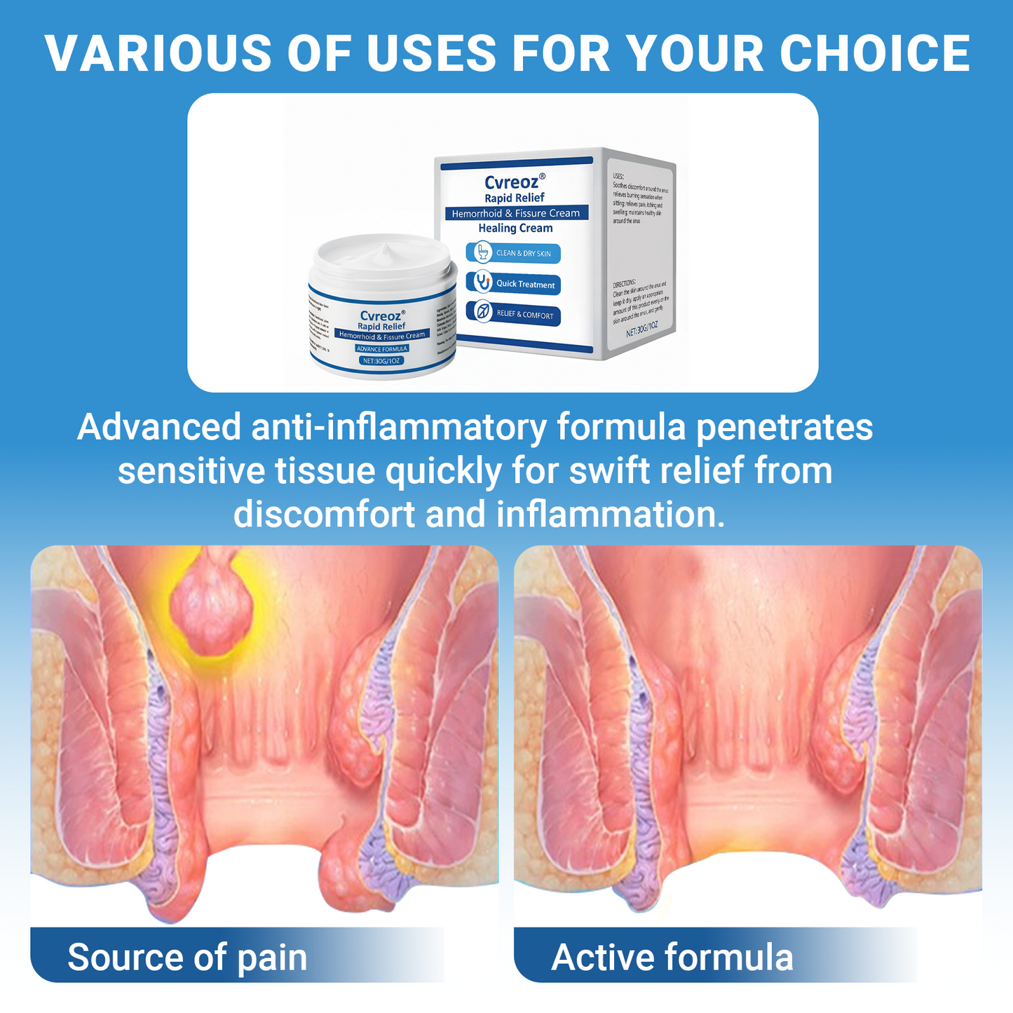 🏆Official Store | Upgraded Formula 🌱 Cvreoz® Rapid Relief Hemorrhoid & Fissure Healing Cream