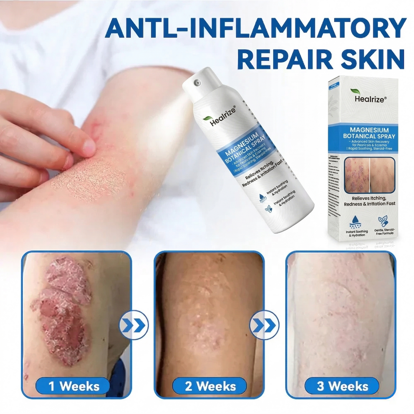 🇺🇸 Official Store| Healrize® Magnesium Botanical Spray – 🥇 Fast Relief for Psoriasis & Eczema | No Rubbing, Steroid-Free