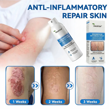 🇺🇸 Official Store| Healrize® Magnesium Botanical Spray – 🥇 Fast Relief for Psoriasis & Eczema | No Rubbing, Steroid-Free