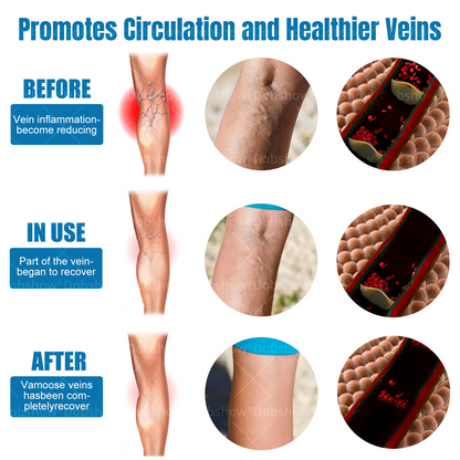 Cvreoz® Varicose Veins Comfort Spray