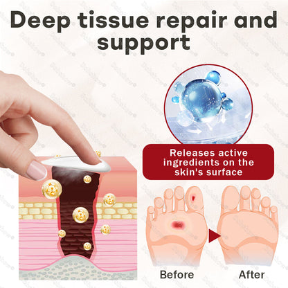 Dobshow® UreaShield Max 30% Diabetic Repair Cream