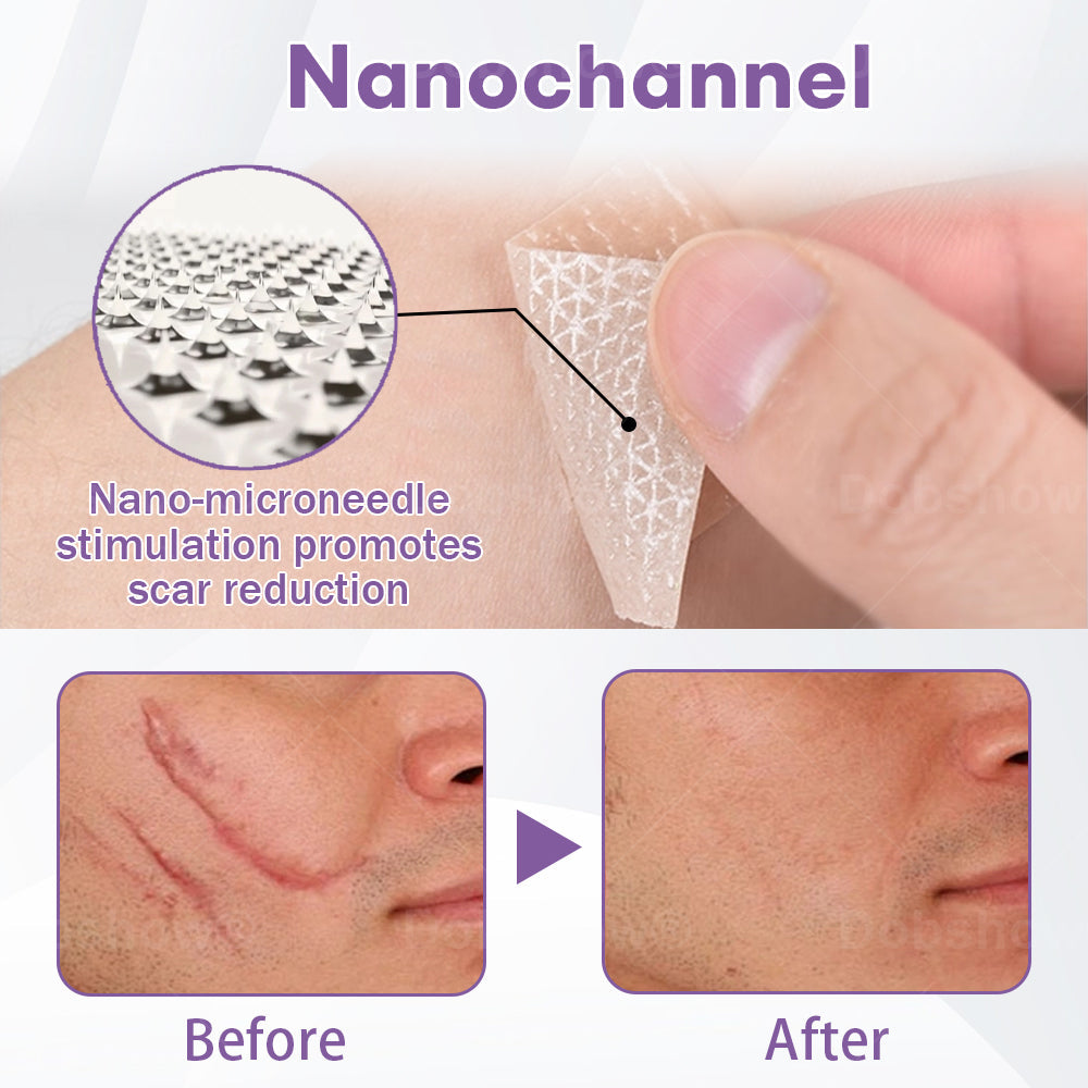 ✅ Complete skin confidence starts here Dobshow® NanoPenetrate Skin Renew Patch ✴️ Effective for all types of scars, stretch marks, blemishes, keloids, keratosis, acne, burns, warts, skin growths, and varicose veins.