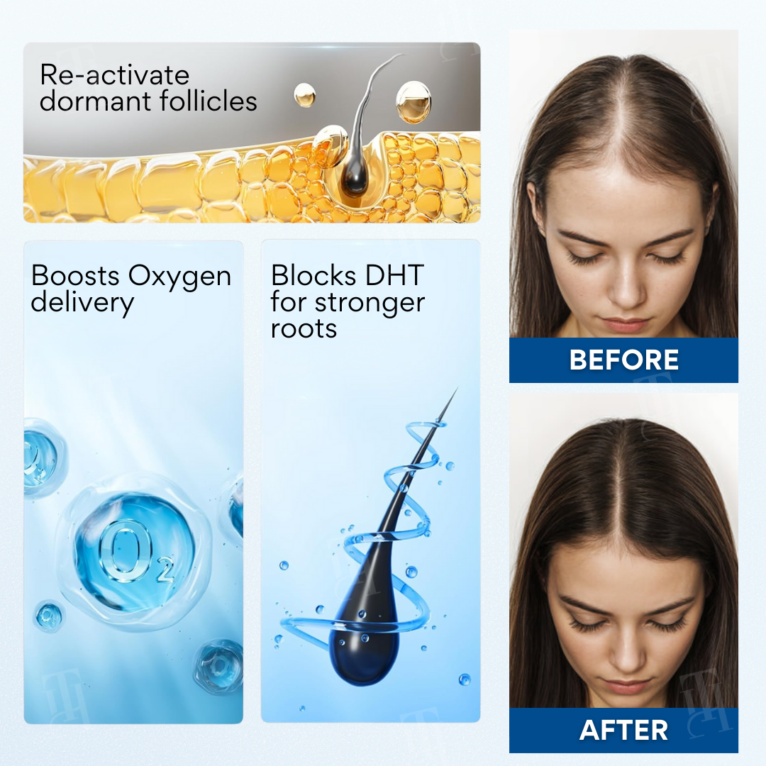 ✨𝙇𝙞𝙢𝙞𝙩𝙚𝙙-𝙏𝙞𝙢𝙚 𝙊𝙛𝙛𝙚𝙧   | Cvreoz® NeuroRoot Reset Roll-On Serum