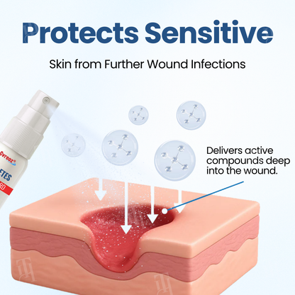 Cvreoz® Diabetes Foot Guard Recovery Spray
