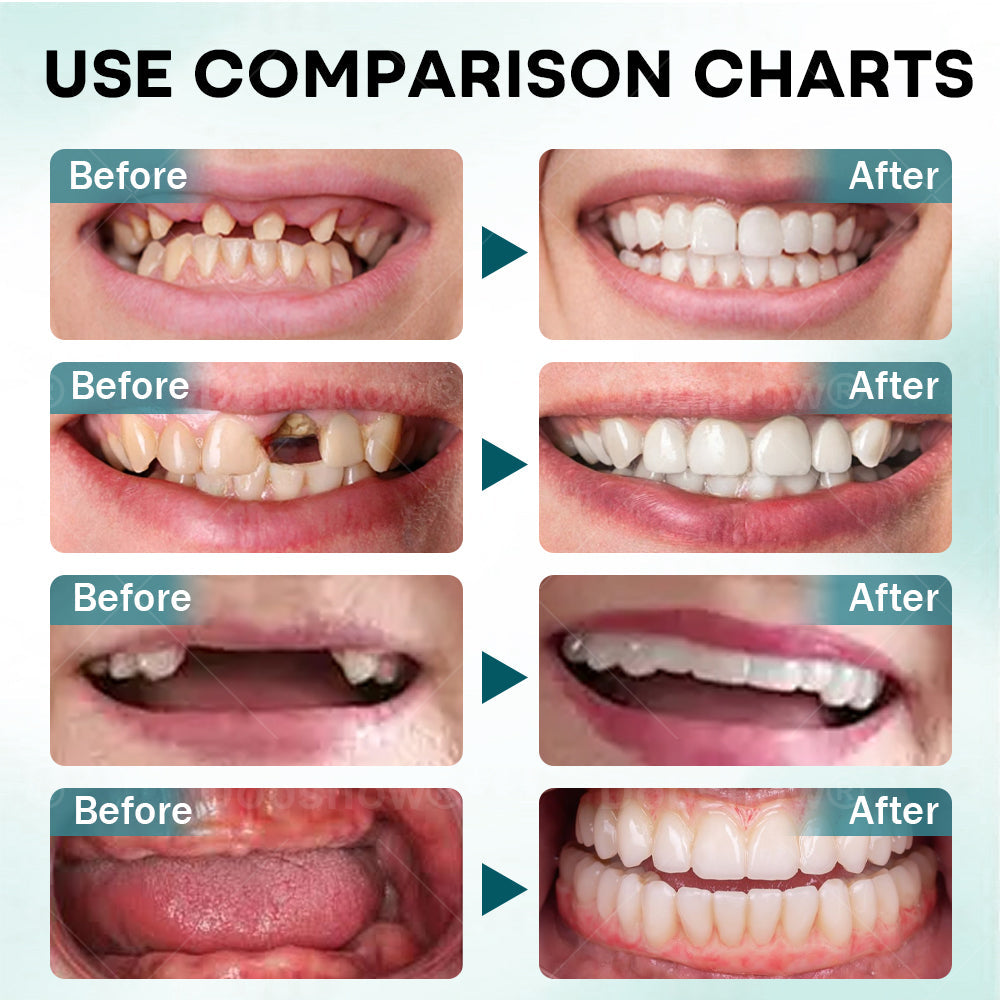 🎅𝘾𝙝𝙧𝙞𝙨𝙩𝙢𝙖𝙨 𝙎𝙖𝙡𝙚 | Dobshow® FirmHold Denture Adhesive