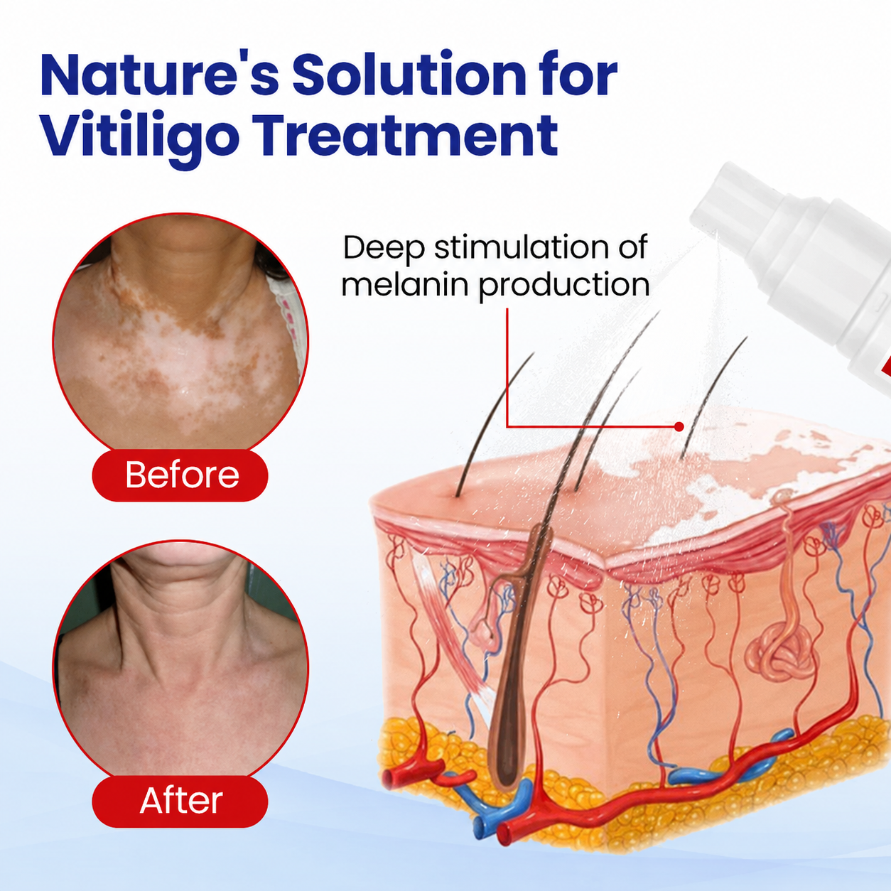 🔥 𝘽𝙚𝙨𝙩 𝙎𝙚𝙡𝙡𝙚𝙧 | Dobshow® Pigment Balance Spray– Targeted Vitiligo & White Patch Care | Supports Melanin Production, Pigment Balance & Natural-Looking Skin Tone