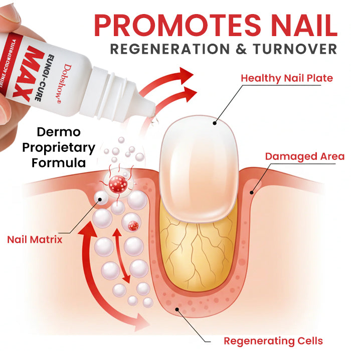 Dobshow® Fungi-Cure Max – Fast-Acting Relief for Fungal Nail Infections