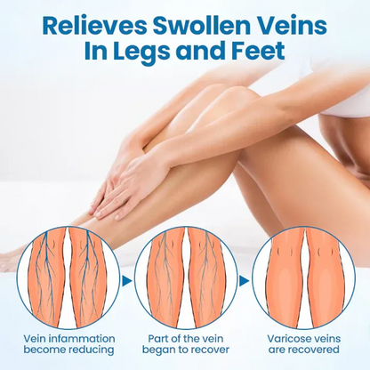 Cvreoz® VeinGuard Herbal Spray-Visible Results in 7 Days or Less. No Pills. No Pain. 💪