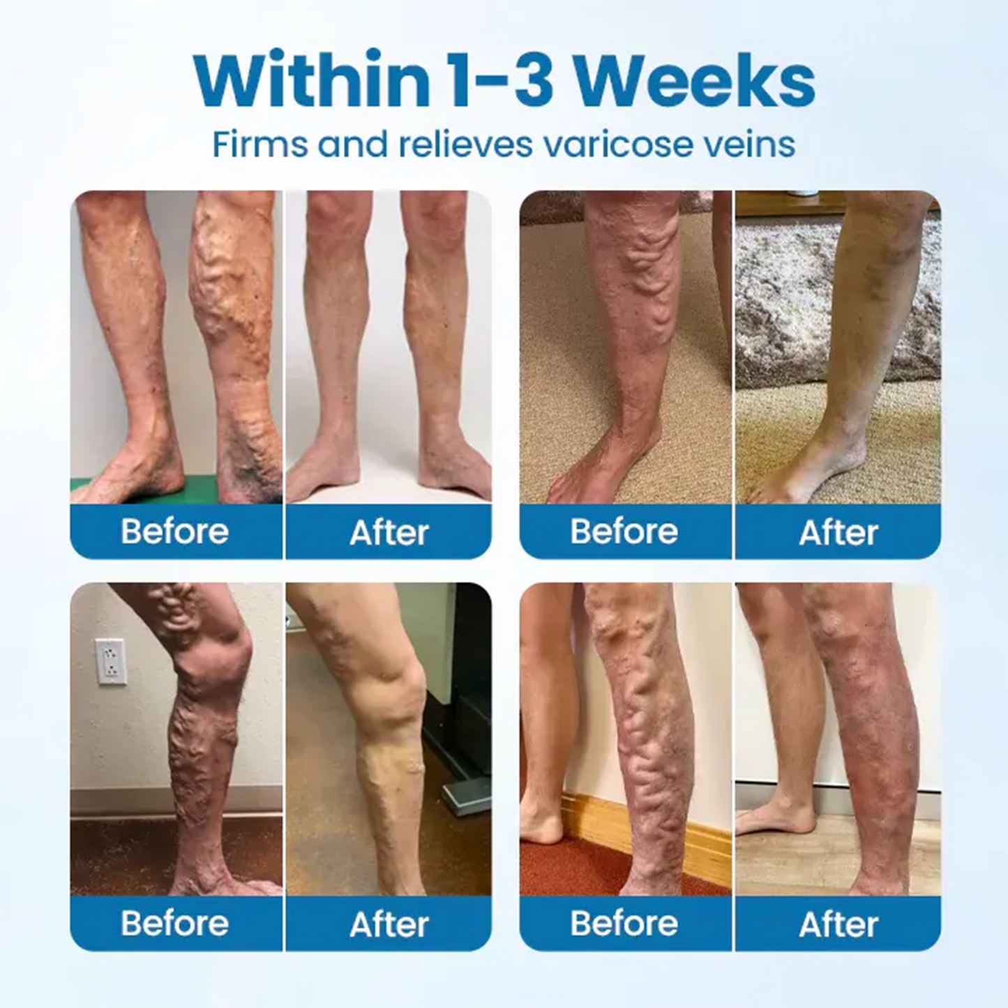 Cvreoz® VeinGuard Herbal Spray-Visible Results in 7 Days or Less. No Pills. No Pain. 💪