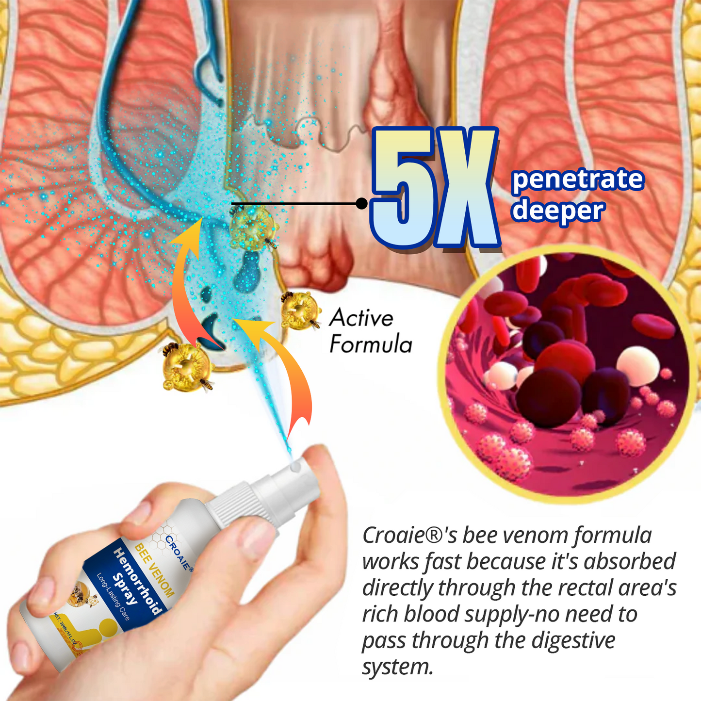 Croaie® Bee Venom Hemorrhoid Spray for Skin, Topical Anesthetic Postpartum Hemorrhoid Treatment with Phenylephrine for Local and Anorectal Uses