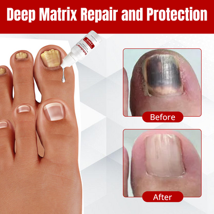 Dobshow® MycoClear Nail Renew Extra Strength
