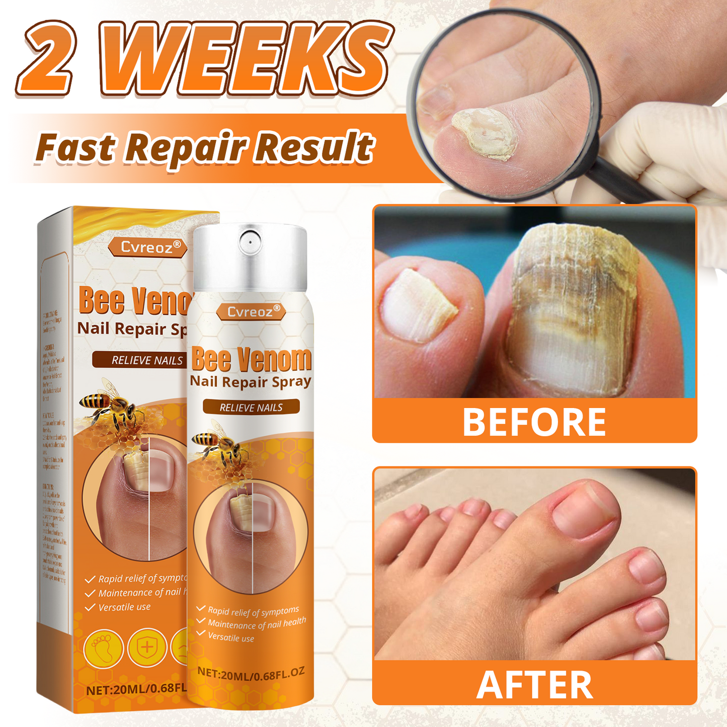 Cvreoz® Bee Venom Nail Repair Spray – Clinically Inspired Relief for Fungal & Damaged Nails👨‍⚕️