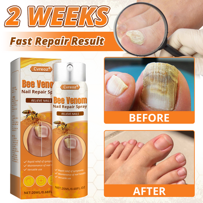 Cvreoz® Bee Venom Nail Repair Spray – Clinically Inspired Relief for Fungal & Damaged Nails👨‍⚕️