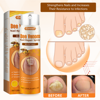 Cvreoz® Bee Venom Nail Repair Spray – Clinically Inspired Relief for Fungal & Damaged Nails👨‍⚕️