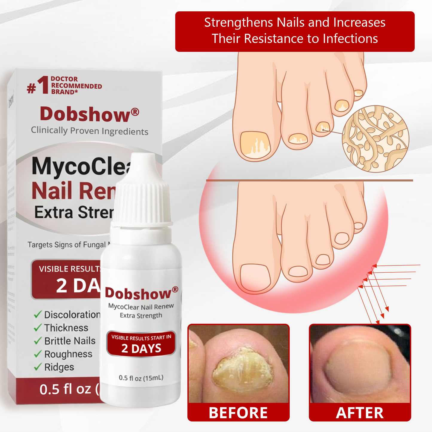 Dobshow® MycoClear Nail Renew Extra Strength