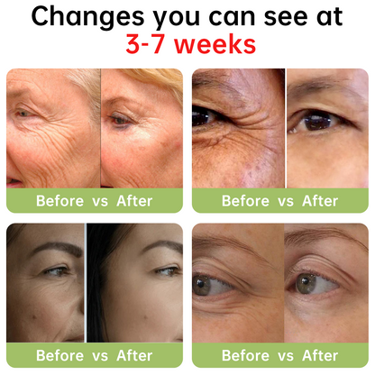 ✅Dobshow™ Luxury Collagen Peptide Firming Cream - Natural Ingredients - 🎖️Clinically Proven🎖️