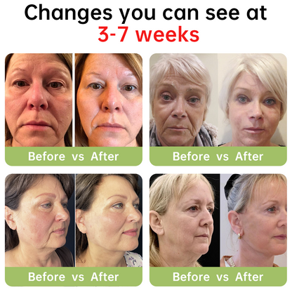 ✅Dobshow™ Luxury Collagen Peptide Firming Cream - Natural Ingredients - 🎖️Clinically Proven🎖️